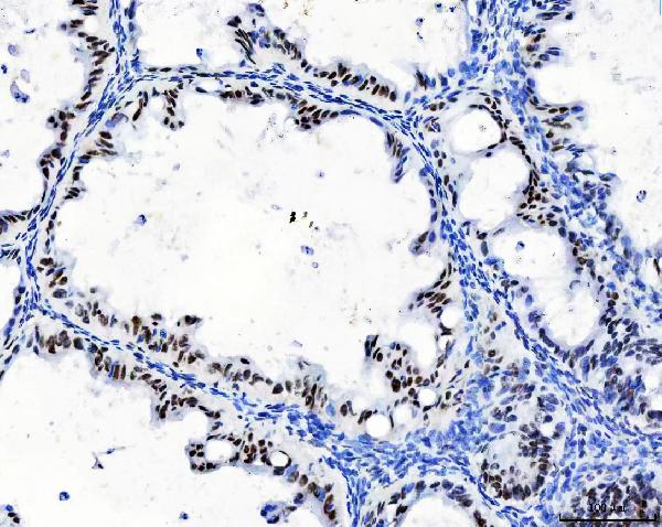IHC - Anti-CPSF6 Antibody Picoband™ (monoclonal, 3F11E1) ABO16592